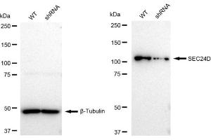 Western blotting analysis using SEC24D antibody (ABIN7800282).