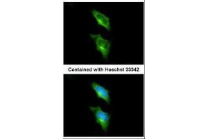 ICC/IF Image Immunofluorescence analysis of methanol-fixed HeLa, using GPR82, antibody at 1:200 dilution. (GPR82 anticorps)