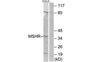 Western blot analysis of extracts from COLO205 cells, using MSHR Antibody. (MC1 Receptor anticorps  (AA 268-317))