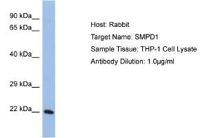 Host: Rabbit Target Name: SMPD1 Sample Tissue: Human THP-1 Whole Cell Antibody Dilution: 1ug/ml (SMPD1 anticorps  (Middle Region))