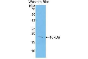 Detection of Recombinant FGF1, Mouse using Polyclonal Antibody to Fibroblast Growth Factor 1, Acidic (FGF1) (FGF1 anticorps  (AA 16-155))