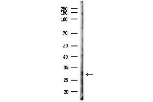Western blot analysis of lysates from PC12 cells(starvation 24h treatment), using RNF138 Antibody at 1/1000 dilution.