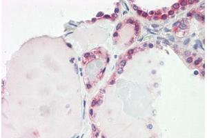 Image no. 2 for anti-Zinc Finger CCCH-Type Containing 15 (ZC3H15) (AA 290-339) antibody (ABIN6749747)