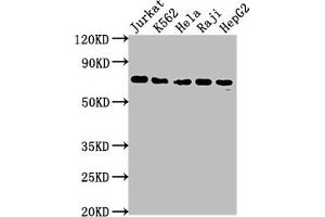 Western Blot Positive WB detected in: Jurkat whole cell lysate, K562 whole cell lysate, Hela whole cell lysate, Raji whole cell lysate, HepG2 whole cell lysate All lanes: FUBP1 antibody at 1:2000 Secondary Goat polyclonal to rabbit IgG at 1/50000 dilution Predicted band size: 68, 69 kDa Observed band size: 69 kDa (Recombinant FUBP1 anticorps)