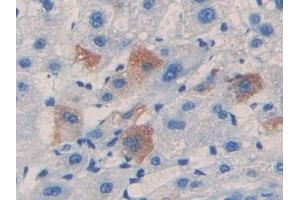 Detection of F5 in Human Liver Tissue using Polyclonal Antibody to Coagulation Factor V (F5)