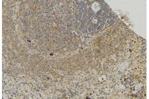 ABIN6272873 at 1/100 staining Human lymph node tissue by IHC-P. (TCTN1 anticorps  (N-Term))