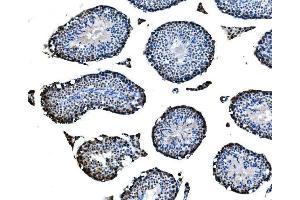 IHC analysis of CBX2 using anti-CBX2 antibody (ABIN7599466). (CBX2 anticorps  (AA 1-532))