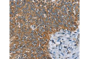 Immunohistochemistry (IHC) image for anti-Ankyrin Repeat and KH Domain Containing 1 (ANKHD1) antibody (ABIN2422951)