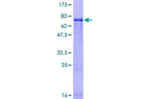 Image no. 1 for Makorin Ring Finger Protein 2 (MKRN2) (AA 1-416) protein (GST tag) (ABIN1310985)