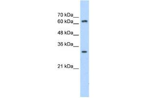 WB Suggested Anti-MTA2 Antibody Titration:  1. (MTA2 anticorps  (C-Term))