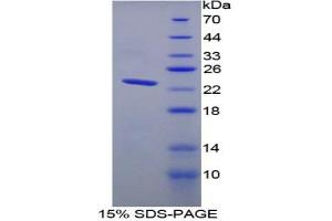 SDS-PAGE analysis of Rat TNNI2 Protein. (TNNI2 Protéine)