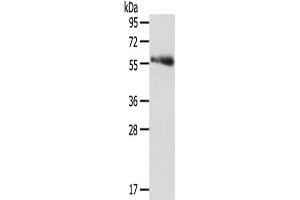 Gel: 8 % SDS-PAGE,Lysate: 40 μg,Primary antibody: ABIN7131190(SRPK3 Antibody) at dilution 1/300 dilution,Secondary antibody: Goat anti rabbit IgG at 1/8000 dilution,Exposure time: 3 minutes (SRPK3 anticorps)