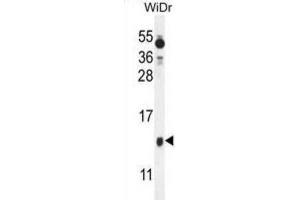 Western Blotting (WB) image for anti-Brain Expressed, X-Linked 1 (BEX1) antibody (ABIN2995790) (BEX1 anticorps)