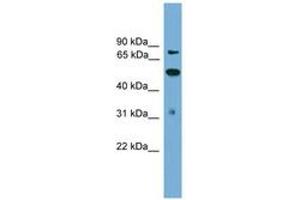 Image no. 1 for anti-Tousled-Like Kinase 2 (TLK2) (AA 35-84) antibody (ABIN6745638) (TLK2 anticorps  (AA 35-84))