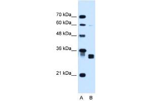 Carbonyl Reductase 1 antibody used at 1. (CBR1 anticorps  (C-Term))