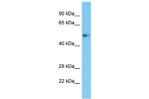 Host:  Rabbit  Target Name:  ZBTB25  Sample Type:  Uterus Tumor lysates  Antibody Dilution:  1. (ZBTB25 anticorps  (Middle Region))