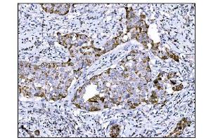 IHC analysis of DLGAP1 using anti-DLGAP1 antibody (ABIN7600257). (DLGAP1 anticorps  (AA 17-319))