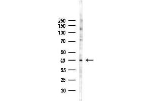 anti-G Protein-Coupled Receptor 87 (GPR87) (Internal Region) antibody