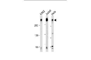 All lanes : Anti-PCM-1 Antibody (C-term) at 1:500-2000 dilution Lane 1: K562 whole cell lysate Lane 2: Jurkat whole cell lysate Lane 3: Hela whole cell lysate Lysates/proteins at 20 μg per lane. (PCM1 anticorps  (C-Term))