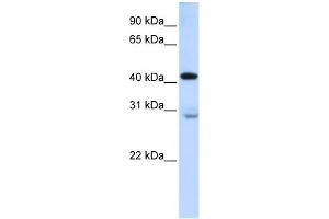 GRAMD2 antibody used at 1 ug/ml to detect target protein. (GRAMD2 anticorps  (Middle Region))
