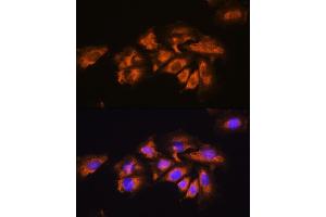 Immunofluorescence analysis of C6 cells using A antibody (ABIN1678588, ABIN3015506, ABIN3015508 and ABIN6218562) at dilution of 1:100. (alpha 1 Adrenergic Receptor anticorps  (AA 346-475))