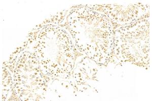ABIN6265200 and ABIN6269069 at 1/100 staining Rat testis tissue by IHC-P. (SNAIL anticorps  (C-Term))