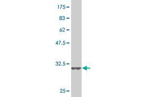 Western Blot detection against Immunogen (34. (SMAD5 anticorps  (AA 105-182))