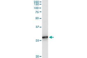 PRDX6 monoclonal antibody (M01), clone 3A10-2A11.