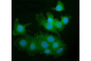 IF analysis of PAK2 using anti-PAK2 antibody (ABIN7599219). (PAK2 anticorps  (AA 1-288))