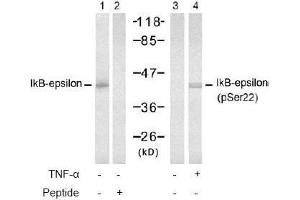 Image no. 2 for anti-Nuclear Factor of kappa Light Polypeptide Gene Enhancer in B-Cells Inhibitor, epsilon (NFKBIE) (pSer22) antibody (ABIN196948) (NFKBIE anticorps  (pSer22))