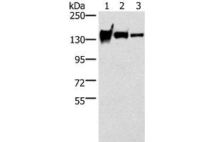 Western Blot analysis of Mouse heart tissue, A172 and 231 cell using R-Cadherin Polyclonal Antibody at dilution of 1:200 (Cadherin 4 anticorps)