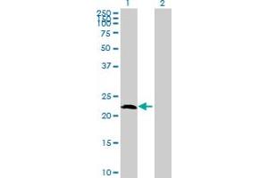 Western Blot analysis of AMELX expression in transfected 293T cell line by AMELX MaxPab polyclonal antibody. (AMELX anticorps  (AA 1-191))