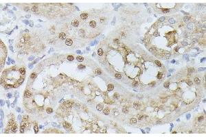 Immunohistochemistry of paraffin-embedded Rat kidney using TPI1 Polyclonal Antibody at dilution of 1:100 (40x lens). (TPI1 anticorps)