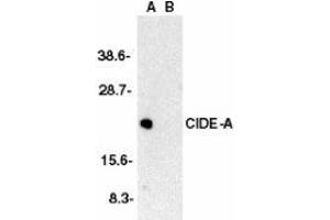 Western blot analysis of CIDE-A in human brain tissue lysate in the absence (A) or presence (B) of peptide with AP30229PU-N CIDE-A antibody at 1/2000 dilution. (CIDEA anticorps  (C-Term))