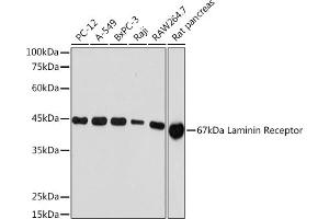 Western blot analysis of extracts of various cell lines, using 67 kDa Laminin Receptor Rabbit mAb (ABIN7270042) at 1:1000 dilution. (RPSA/Laminin Receptor anticorps)