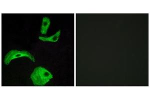 Immunofluorescence analysis of HeLa cells, using GPR18 antibody. (GPR18 anticorps  (Internal Region))