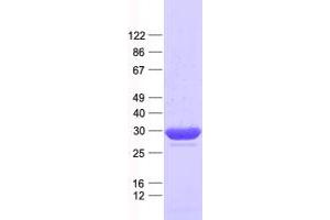 Validation with Western Blot