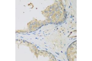Immunohistochemistry of paraffin-embedded human prostate using LLGL2 antibody (ABIN5975836) at dilution of 1/200 (40x lens). (LLGL2 anticorps)