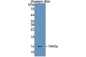 Western blot analysis of the recombinant protein. (SRP9 anticorps  (AA 2-86))