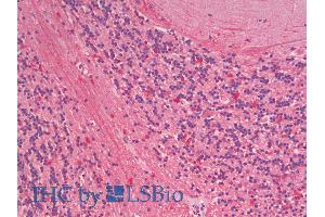 ABIN1590014 (5µg/ml) staining of paraffin embedded Human Cerebellum. (ZNRF1 anticorps  (Internal Region))