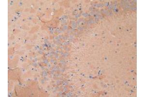 Figure. (Dynamin 1 anticorps  (AA 572-745))