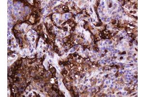 Image no. 11 for anti-Mucin 1 (MUC1) antibody (ABIN1499598)