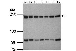 WB Image Sample(30μg whole cell lysate) A: 293T B: A431 , C: H1299 D: HeLa S3 , E: Hep G2 , F: MOLT4 , G: Raji , 5% SDS PAGE antibody diluted at 1:1000