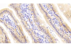 Detection of RBP2 in Mouse Colon Tissue using Polyclonal Antibody to Retinol Binding Protein 2, Cellular (RBP2)