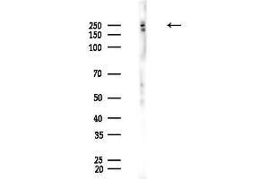 Western blot analysis of lysates from EC304 cells, using FASN Antibody at 1/1000 dilution.