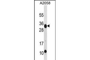 RAET1E Antibody (Center) (ABIN1881724 and ABIN2838636) western blot analysis in  cell line lysates (35 μg/lane). (Retinoic Acid Early Transcript 1E (RAET1E) (AA 150-179) anticorps)