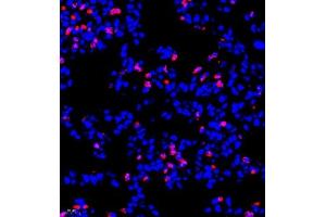 Immunofluorescence of paraffin embedded rat pneumonia using CD177 (ABIN7073372) at dilution of 1:500 (400x lens)
