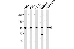 All lanes : Anti-PCSK1 Antibody (C-Term) at 1:2000 dilution Lane 1: Hela whole cell lysate Lane 2: A549 whole cell lysate Lane 3: PC-12 whole cell lysate Lane 4: mouse brain lysate Lane 5: NCI- whole cell lysate Lysates/proteins at 20 μg per lane.