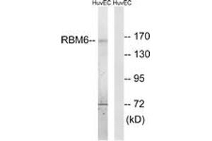 Western blot analysis of extracts from HuvEc cells, using RBM6 Antibody. (RBM6 anticorps  (AA 991-1040))