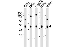 Western blot analysis of lysates from A431, Hela, HepG2 cell line , human liver and mouse liver tissue lysate(from left to right), using ETFA Antibody (Center) (ABIN6243648 and ABIN6577412). (ETFA anticorps  (AA 192-226))